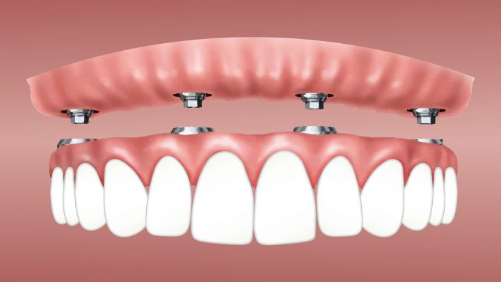 Nie warto unikać wizyt u dentysty