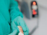 Czy każdy może mieć protezę całkowitą na implantach?