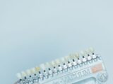 Czy licówki zębowe mogą poprawić kształt zębów bez leczenia ortodontycznego?