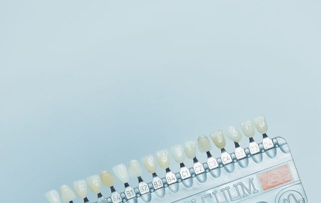 Czy licówki zębowe mogą poprawić kształt zębów bez leczenia ortodontycznego?